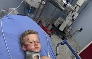 O garoto doce de 8 anos quebra o silêncio depois que o motorista de calo o deixa cair: ‘Dói muito’