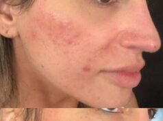 Por que o item ‘revolucionário’ de Doc está saindo das prateleiras: ‘Isso me fez chorar’