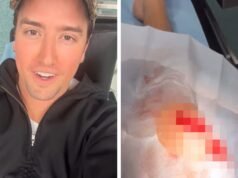 Logan do Big Time Rush é levado ao hospital após cortar o joelho no palco, veja a foto