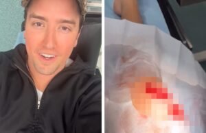 Logan do Big Time Rush é levado ao hospital após cortar o joelho no palco, veja a foto