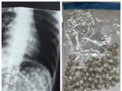 Preso em liberdade provisória MG passou mal após engolir 61 pedaços de maconha; Suspeita-se que ele tentava voltar para a prisão com drogas