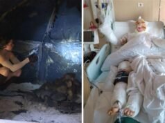 Mulher de Albany gravemente ferida em explosão de sauna subterrânea interna