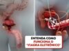 Viagra eletrônico: aparelho de fabricação brasileira restaura ereções em 90% dos pacientes do estudo