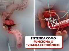 Viagra eletrônico: aparelho de fabricação brasileira restaura ereções em 90% dos pacientes do estudo