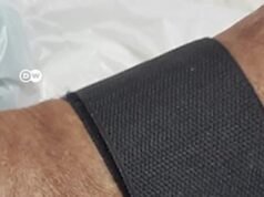 Tecnologia brasileira visa reduzir número de amputações por diabetes