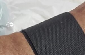 Tecnologia brasileira visa reduzir número de amputações por diabetes