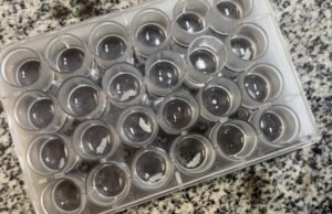 Como Covid e Oropouche podem prever o risco de doenças cerebrais