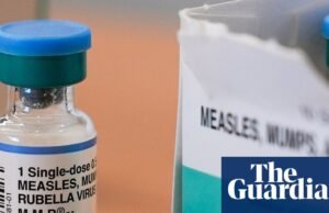 Autoridades da Carolina do Sul relatam surto de sarampo crescendo “rapidamente” Carolina do Sul