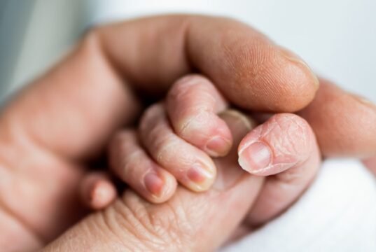 A confusão sobre as diretrizes do painel do CDC para hepatite B pode atrapalhar o cuidado das crianças