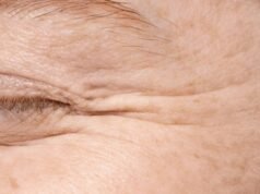 Não seja descuidado! O processo de envelhecimento da pele começa a partir dos 30 anos, deve ser feito