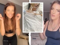 A mãe de Perth, Chloe Moday, está lutando pela vida no Vietnã após uma cirurgia no nariz e nas pálpebras que deu terrivelmente errado