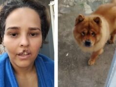 A tutora que arrancou parte do lábio conta como está