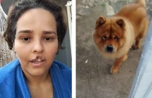 A tutora que arrancou parte do lábio conta como está