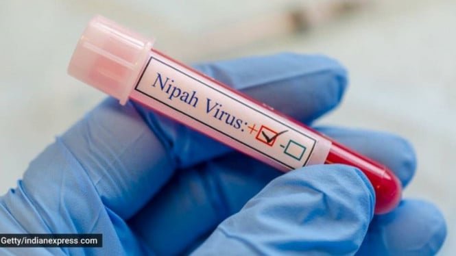 60d546b330e0c-virus-nipah_665_374.jpg
