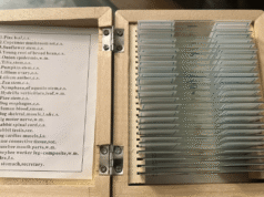 As pessoas acham o incomum na Goodwill, descobrindo o interior do sangue das pessoas em casa