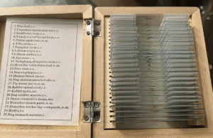 As pessoas acham o incomum na Goodwill, descobrindo o interior do sangue das pessoas em casa