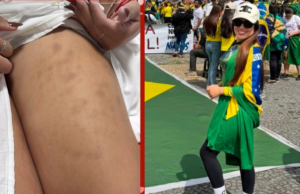 ‘Fui atingido no peito e só tremia’, diz empresária cuiabana atingida por raio durante protesto em Brasília