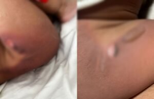 Pai de bebê queimado enquanto tomava banho em creche lamenta demora em ser avisado da situação: ‘Meu filho sofreu’