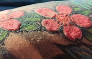 Reações raras a tatuagens fazem com que as pessoas percam cabelo, parem de suar e desenvolvam vitiligo