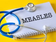 Mapa mostrando a prevalência do sarampo nos Estados Unidos