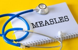 Mapa mostrando a prevalência do sarampo nos Estados Unidos