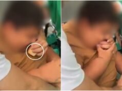 Aluno obrigado a comer 7 pedaços de bolo na escola tem síndrome que o faz engordar com facilidade