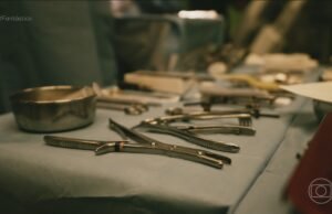 Segundo pesquisa da USP, 73% dos cirurgiões afirmaram já ter operado algum paciente para retirada de corpo estranho.