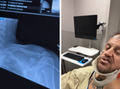 Jelly Roll estava no Grammy com uma clavícula quebrada devido a um acidente de quadriciclo, coelho posta vídeo