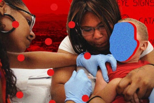 ‘As crianças estão com medo’: médicos do sarampo falam